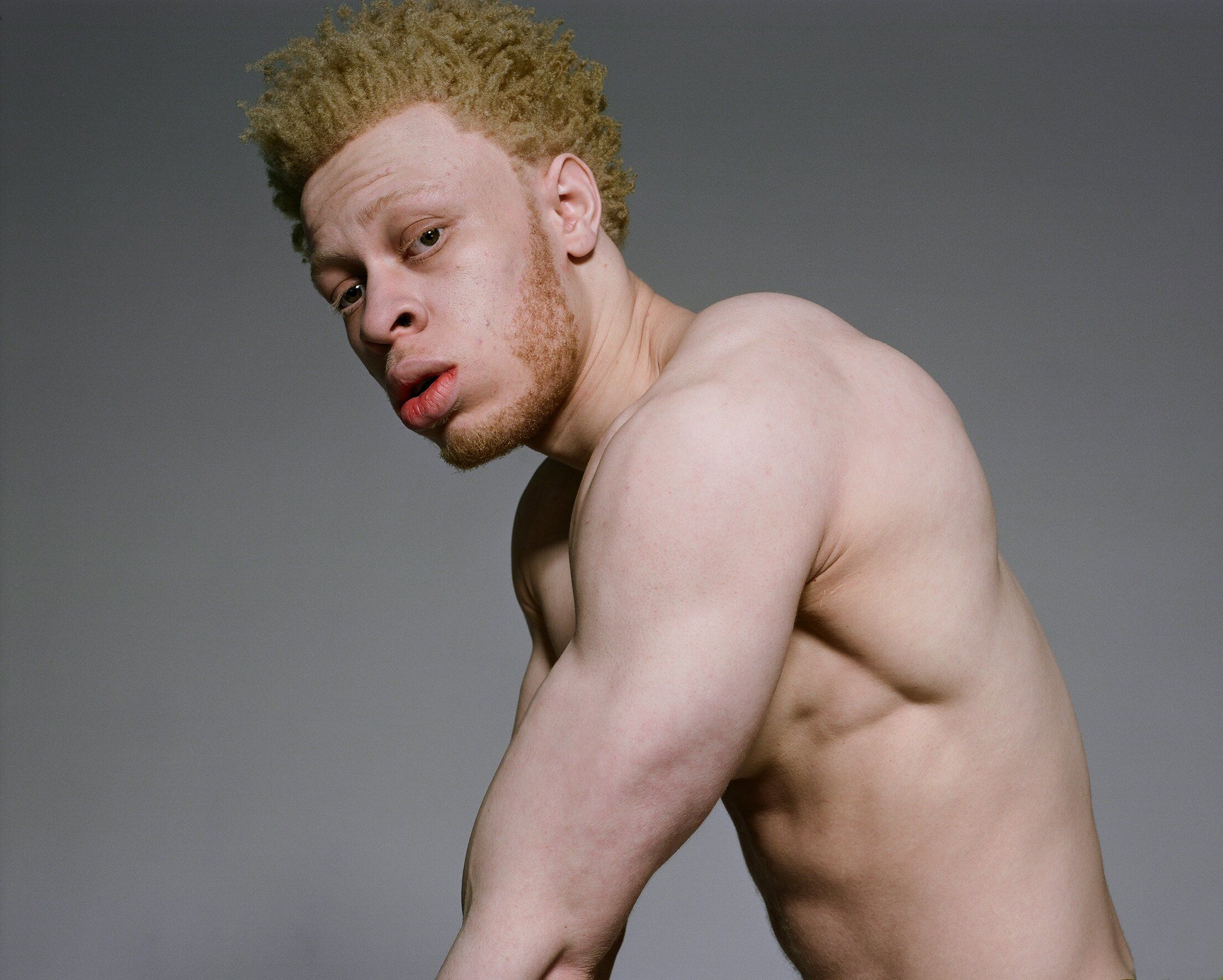 Albinos men and men sex picss